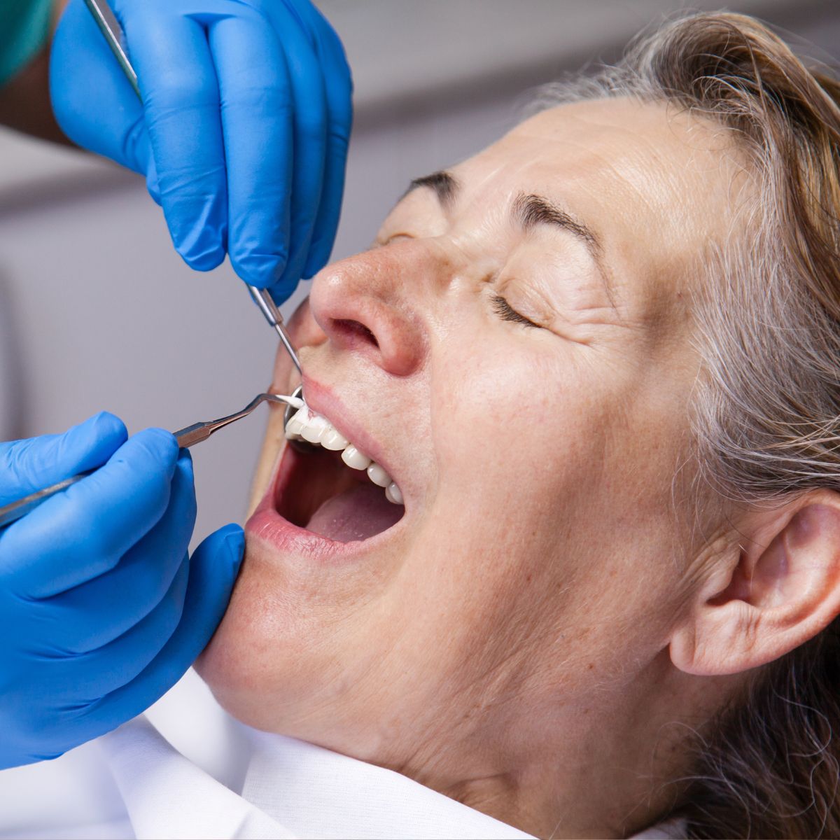 Diagnostika parodontalne bolezni